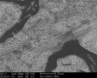 /static/micrographs/micrograph1005.png