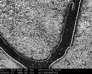 /static/micrographs/micrograph1020.png