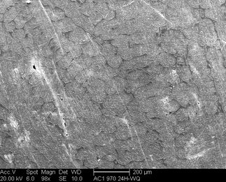 /static/micrographs/micrograph1075.png
