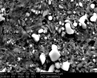 /static/micrographs/micrograph1096.png