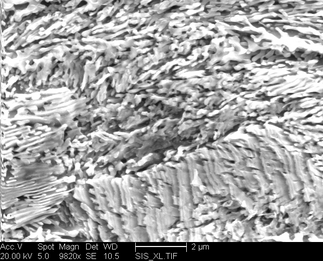 /static/micrographs/micrograph1119.png