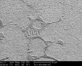 /static/micrographs/micrograph1156.png