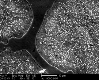 /static/micrographs/micrograph1205.png