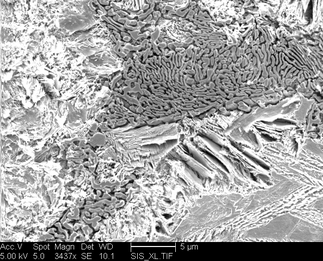 /static/micrographs/micrograph1294.png