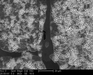 /static/micrographs/micrograph1366.png