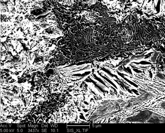 /static/micrographs/micrograph1393.png