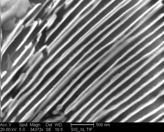 /static/micrographs/micrograph1397.png