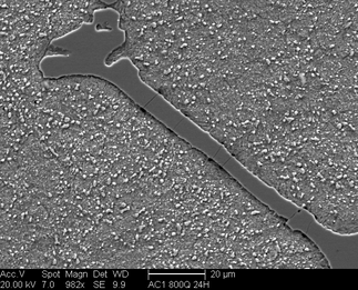 /static/micrographs/micrograph1423.png