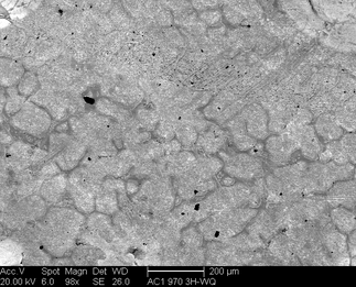 /static/micrographs/micrograph1468.png