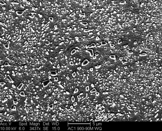 /static/micrographs/micrograph148.png