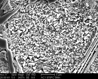/static/micrographs/micrograph1549.png