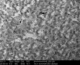 /static/micrographs/micrograph1552.png