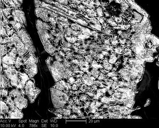 /static/micrographs/micrograph1582.png
