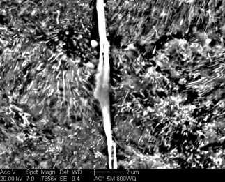 /static/micrographs/micrograph1605.png