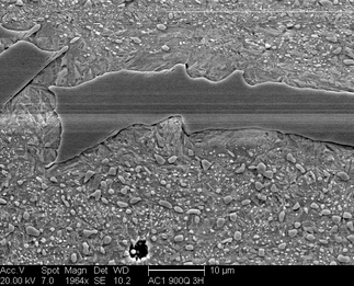 /static/micrographs/micrograph161.png