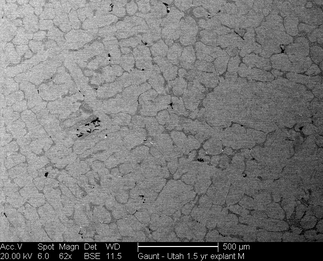/static/micrographs/micrograph1625.png