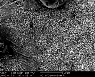 /static/micrographs/micrograph1640.png