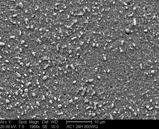 /static/micrographs/micrograph170.png