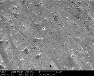 /static/micrographs/micrograph177.png