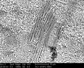 /static/micrographs/micrograph214.png
