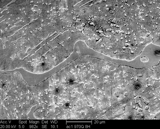 /static/micrographs/micrograph248.png
