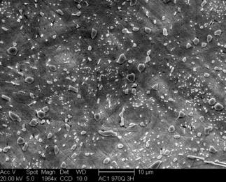 /static/micrographs/micrograph319.png