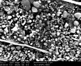 /static/micrographs/micrograph375.png