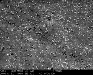 /static/micrographs/micrograph388.png