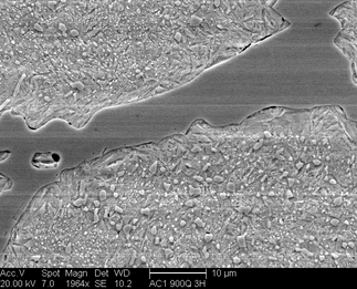 /static/micrographs/micrograph407.png
