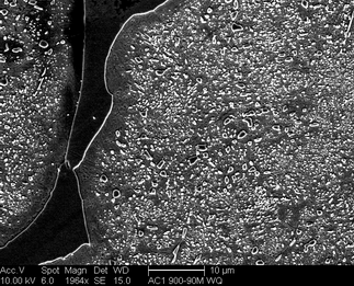 /static/micrographs/micrograph470.png