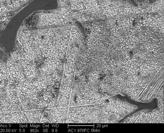 /static/micrographs/micrograph475.png