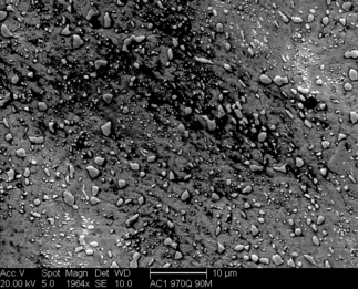 /static/micrographs/micrograph536.png