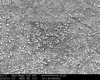 /static/micrographs/micrograph670.png
