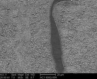 /static/micrographs/micrograph705.png