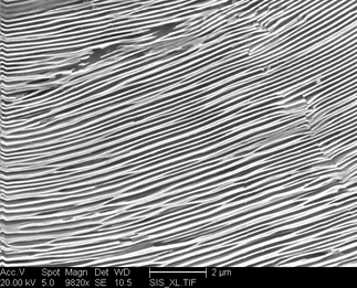 /static/micrographs/micrograph744.png