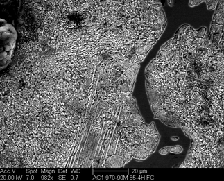 /static/micrographs/micrograph749.png
