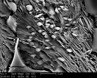 /static/micrographs/micrograph765.png