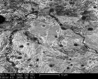 /static/micrographs/micrograph771.png