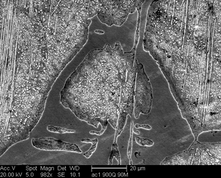 /static/micrographs/micrograph873.png