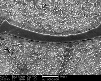 /static/micrographs/micrograph894.png