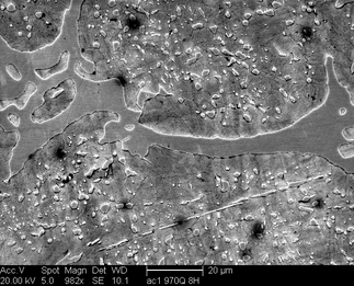 /static/micrographs/micrograph947.png