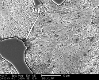 /static/micrographs/micrograph985.png