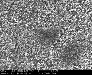 /static/micrographs/micrograph995.png